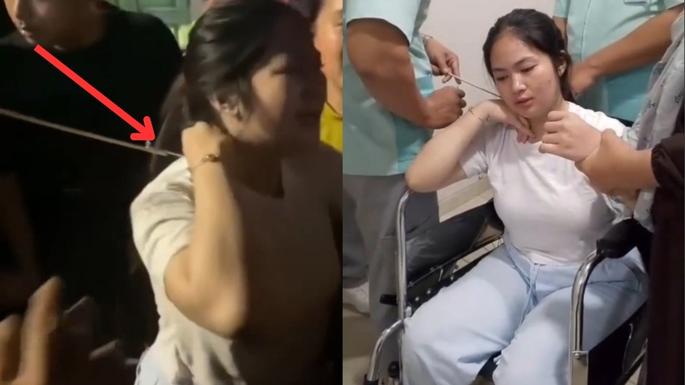 Mencekam, Wanita di Makassar Jadi Korban Busur Nyasar Saat Hendak Beli Bakso