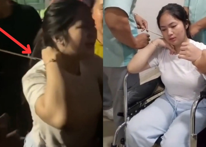 Mencekam, Wanita di Makassar Jadi Korban Busur Nyasar Saat Hendak Beli Bakso